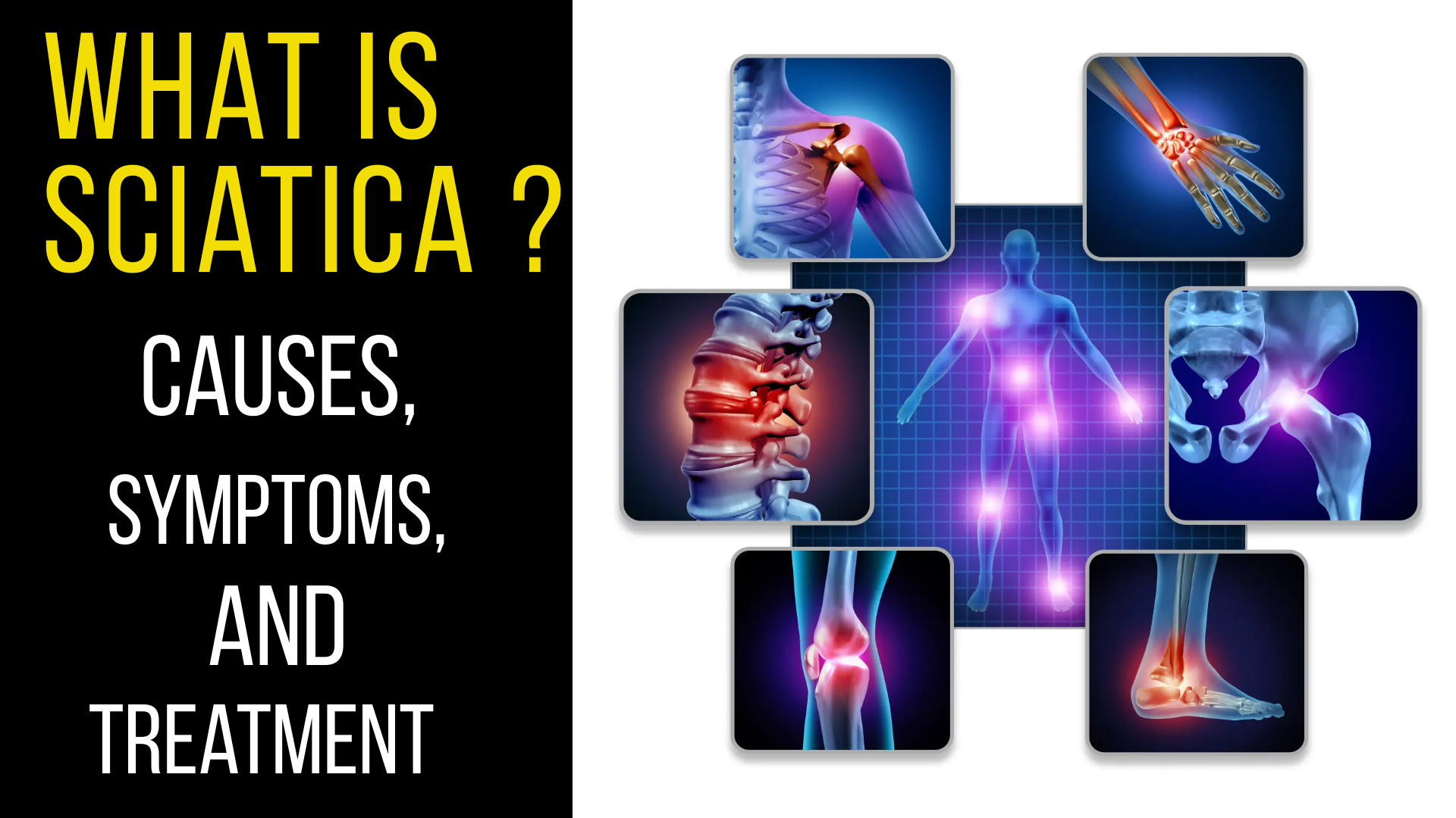 https://medinutrica.com/wp-content/uploads/2023/09/What-is-Sciatica-Causes-Symptoms-and-Treatment.jpg