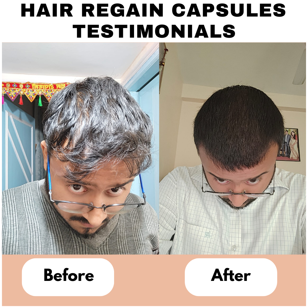 Hair regain capsules review