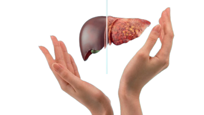 What is Fatty Liver?